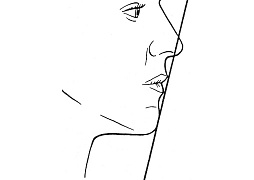 <i>Reidel's</i> line