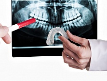 Your Chin as the Basis of Appearance. Face Analysis before the Operation